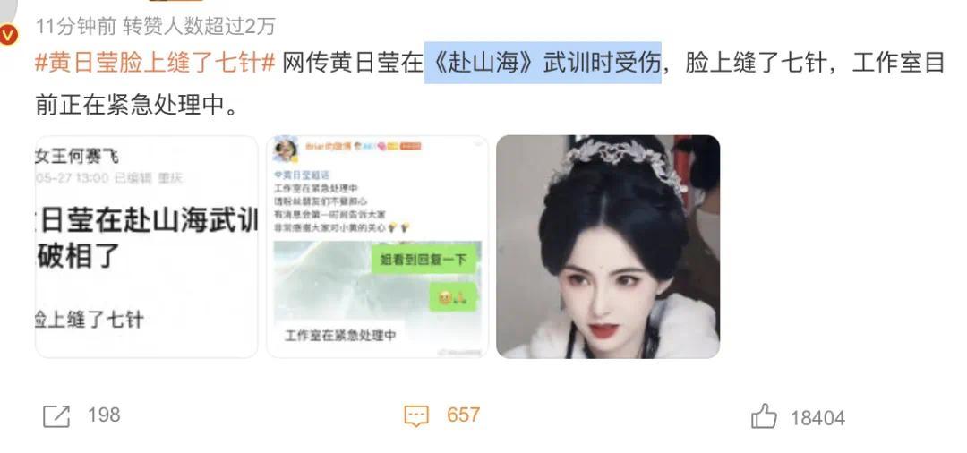 “天哪，她和李若彤超像的！30岁女演员武训时不小心受伤，脸上缝了7针”插图