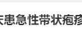 蔡国庆硬扛带状疱疹疼痛，坚持完成节目录制：真男人不轻言放弃！缩略图